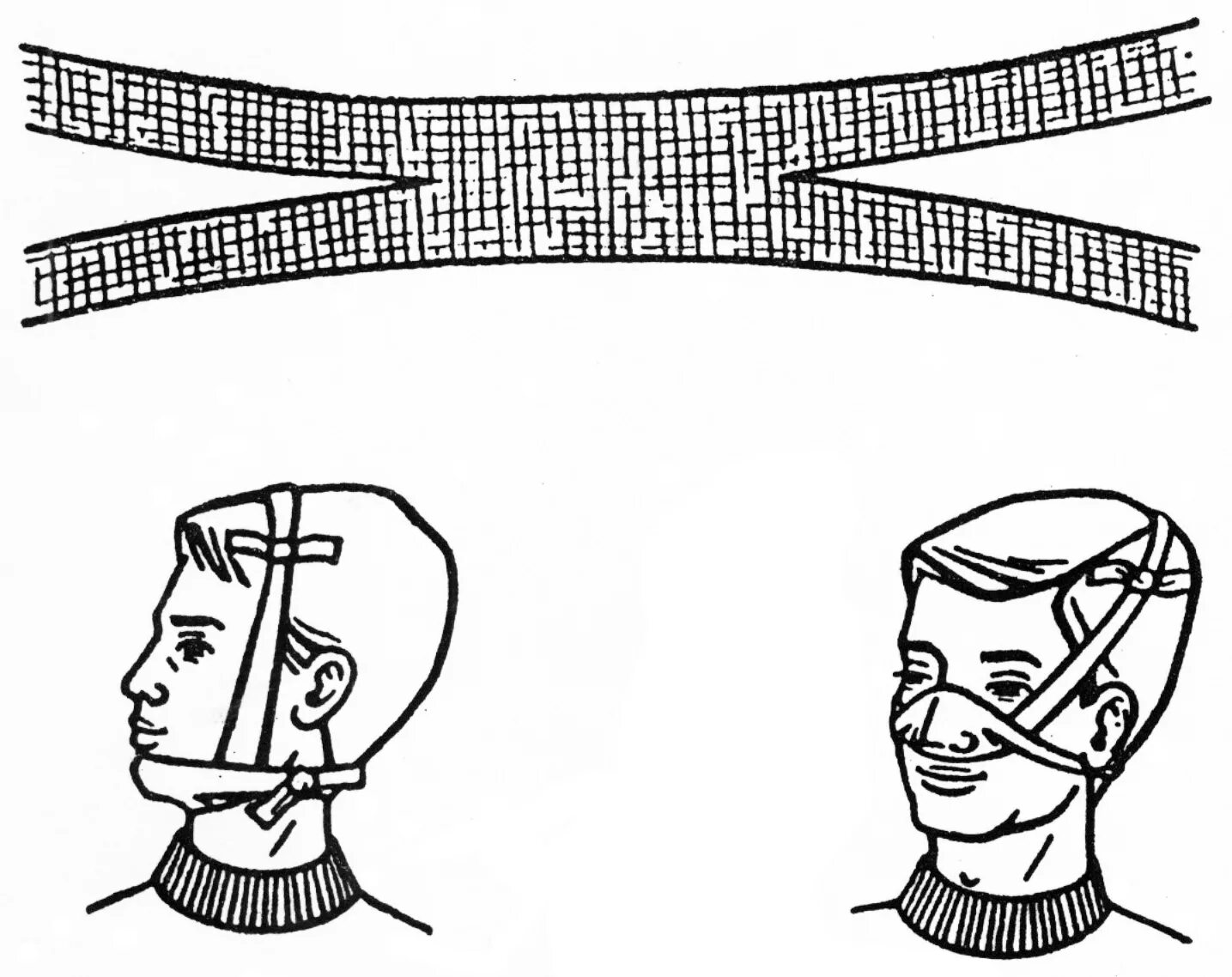 Техника наложения пращевидной повязки. Пращевидная повязка алгоритм. Пращевидная повязка на нос алгоритм. Пращевидная повязка на подбородок алгоритм.