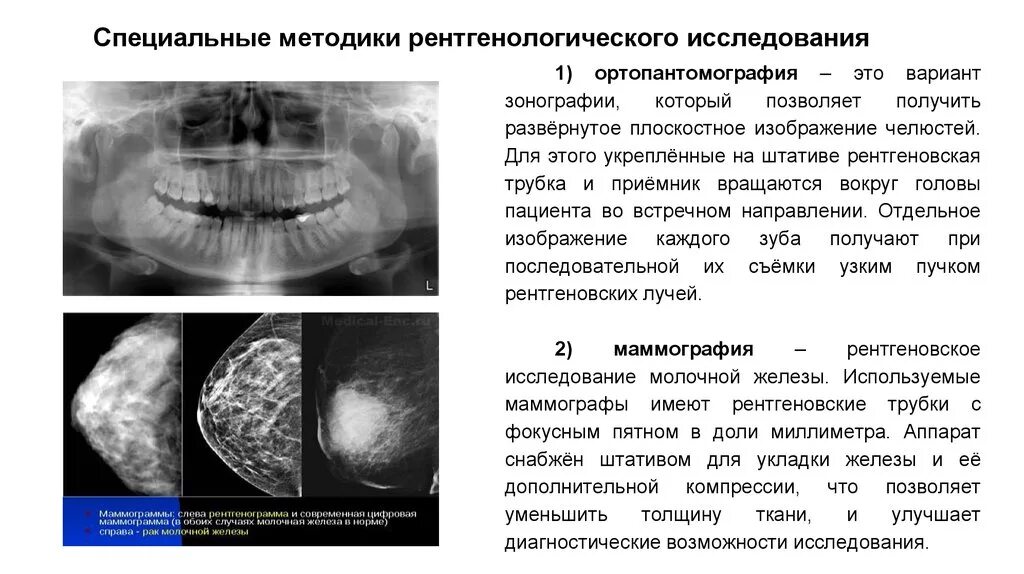 Рентгенологическое исследование определение