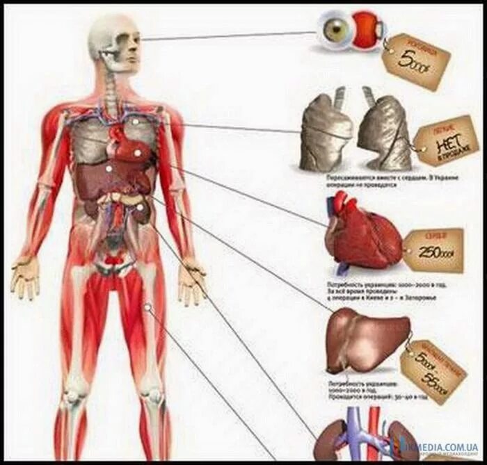 Продажа органов человека. Незаконная трансплантация органов. Органы человека на черном рынке.