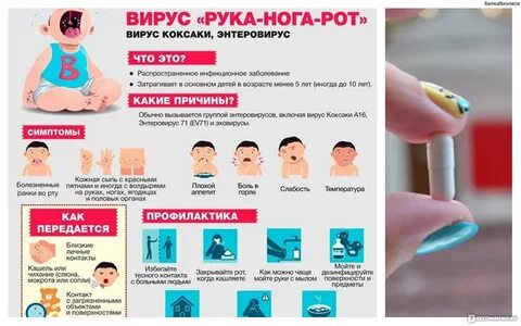Симптомы вируса коксаки