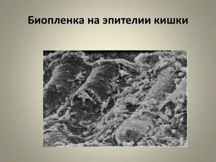 Биопленка