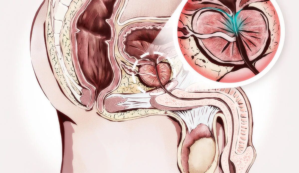 Простата хочет. Предстательная железа у мужчин. Массаж предстательной железы. Застойный простатиты у мужчин.