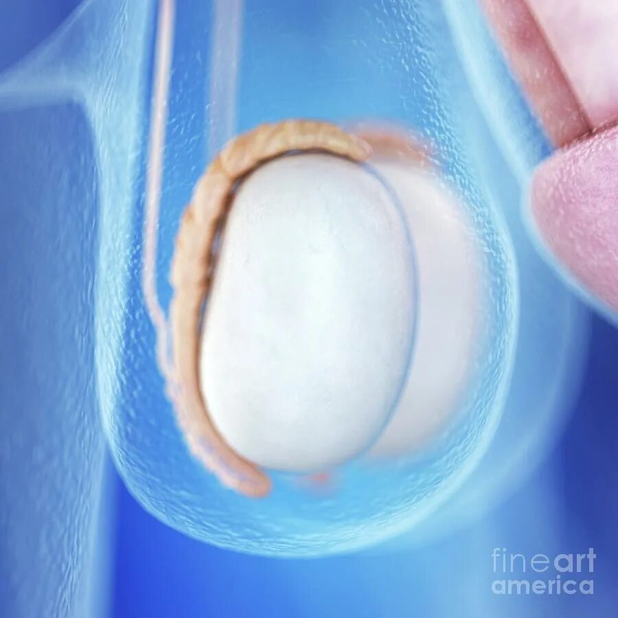 что внутри мужских яиц. анатомия семенников. строение яиц у мужчин. фасциальные оболочки яичка. что внутри мужских яиц.