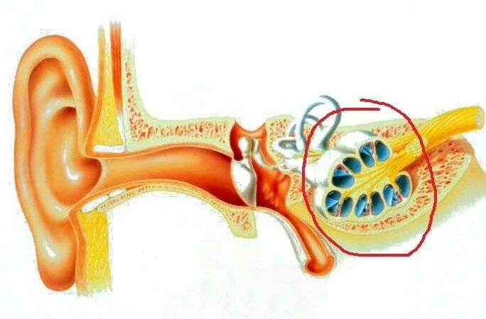 Болезни внутреннего уха Меньера. Лабиринтит ЛОР болезни. Внутреннее ухо лабиринтит болезнь. Болезнь внутреннего уха