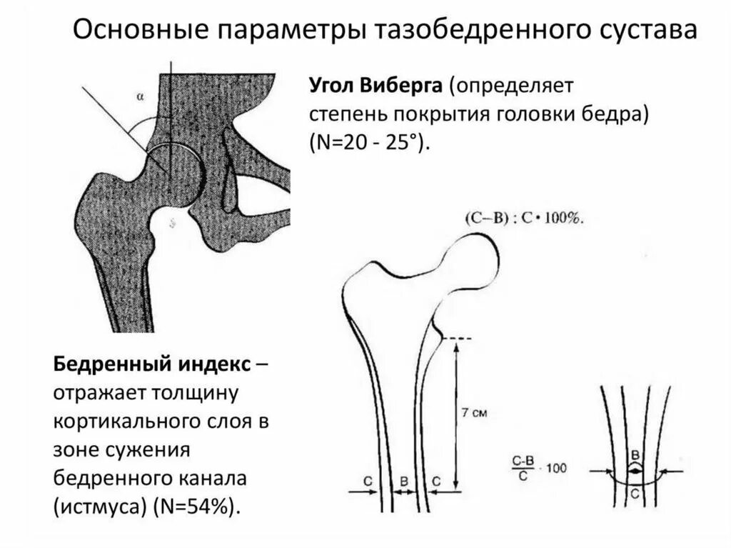 Дисплазия тазобедренных суставов ацетабулярный угол норма. Снимок бедренной кости в норме. Угол вертикального соответствия тазобедренных суставов. Дисплазия тазобедренного сустава 2 а.