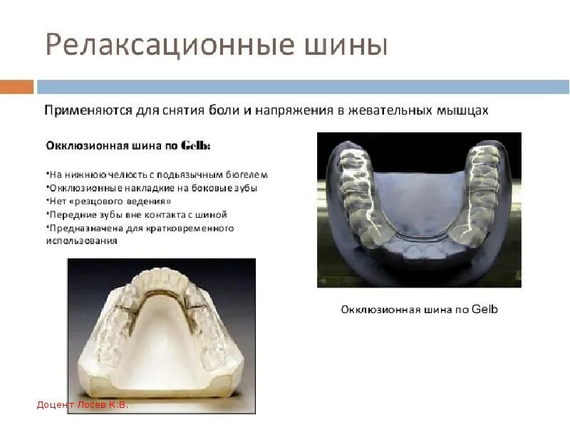 Кольцевая шина. Репозиционная окклюзионная шина.