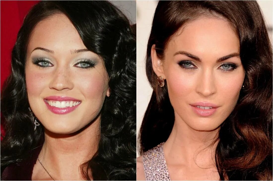 Дженис дикинсон комки биша. Виктория бекхэм ринопластика. Меган фокс комки биша. Виктория бекхэм до пластики. Донателла версаче неудачная пластика.