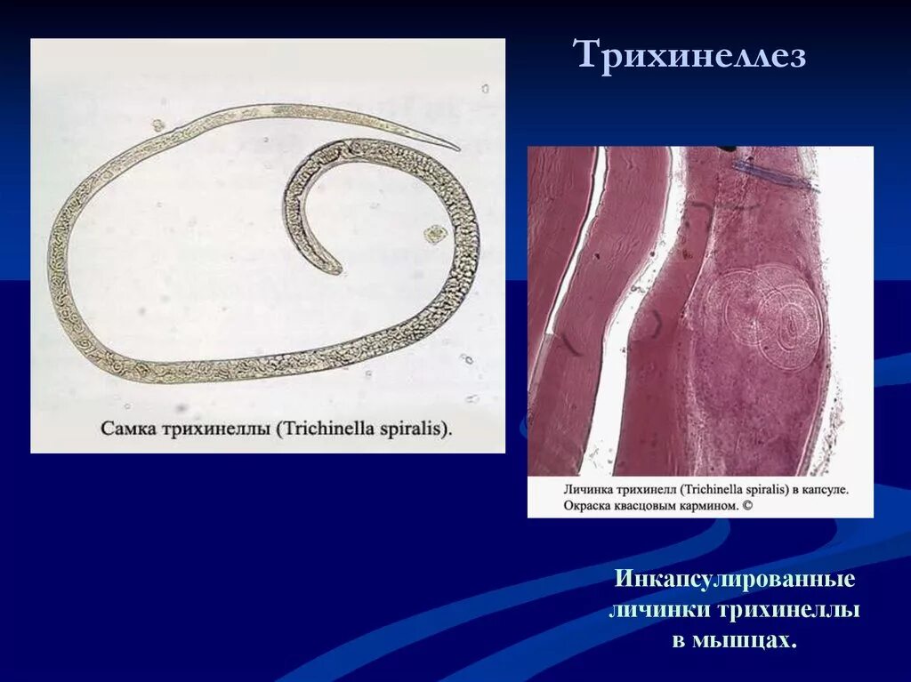 Трихинелла спиральная - Trichinella spiralis. Трихинелла Спиралис личинки. Паразитические круглые черви трихинелла.