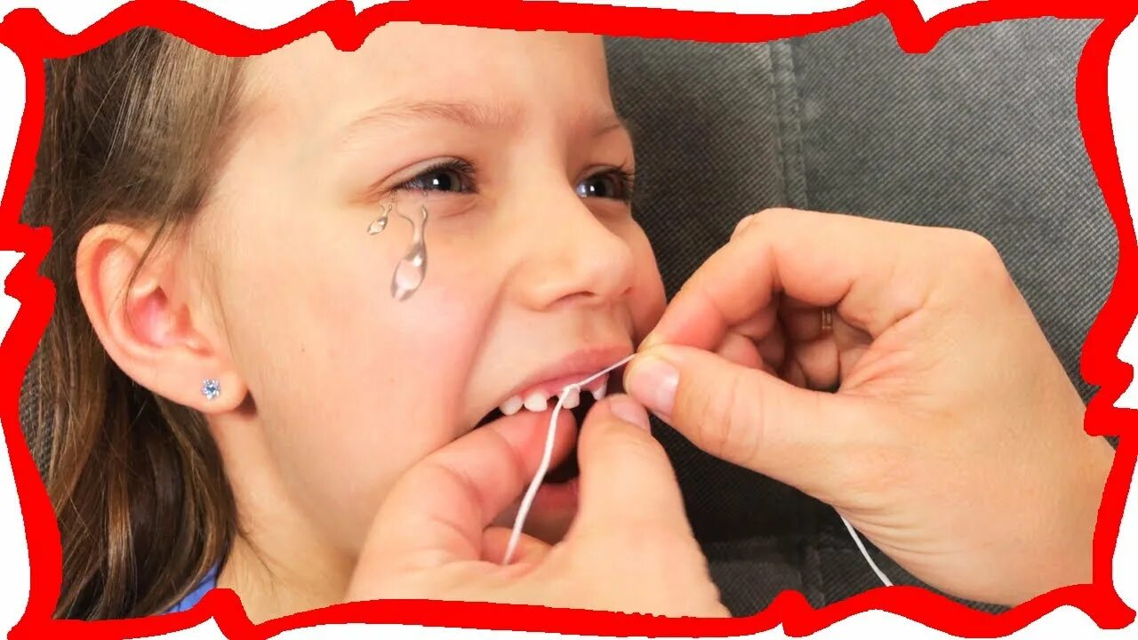 Вырвать зуб ниткой ребенку. Как выдернуть зуб ребенку ниткой. Пассатижами выдирают зуб. Как выдернуть молочный зуб ребёнку. Вырвать молочный зуб ниткой.