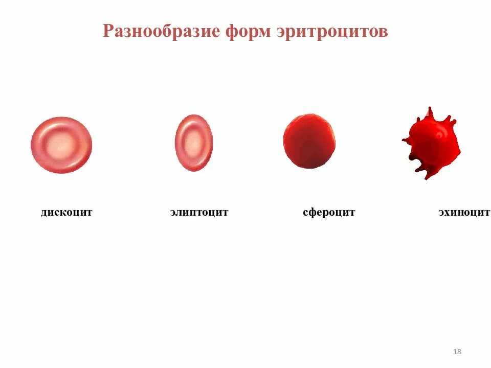 Изменение формы и окраски. Форма эритроцитов человека. Формы эритроцитов эхиноциты сфероциты. Стареющие формы эритроцитов. Изменение величины эритроцитов.