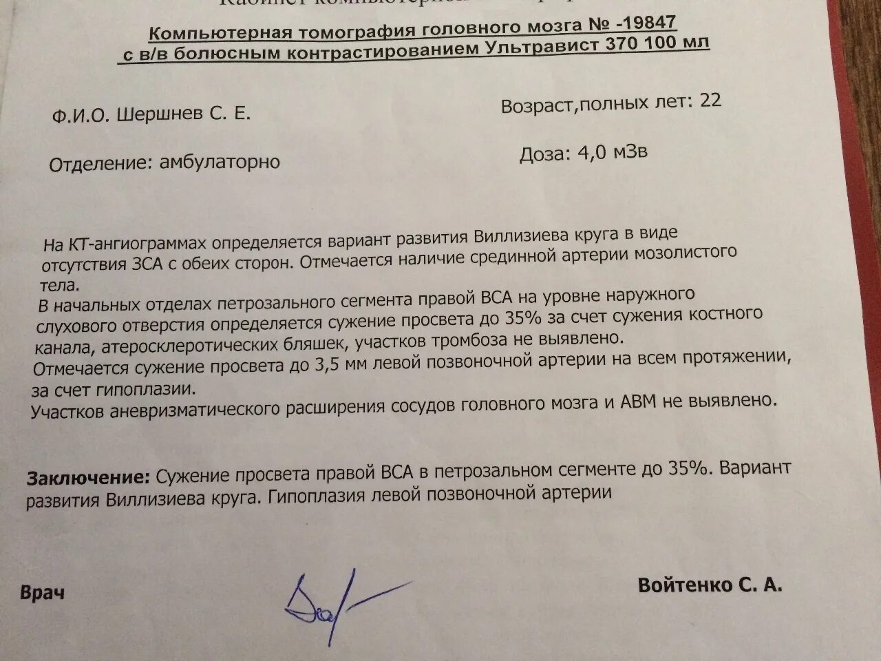 Гипоплазия интракраниального сегмента. Гипоплазия позвоночной артерии диаметр. гипоплазия позвоночной артерии кт. гипоплазия позвоночной артерии на узи. гипоплазия сосудов головного мозга.