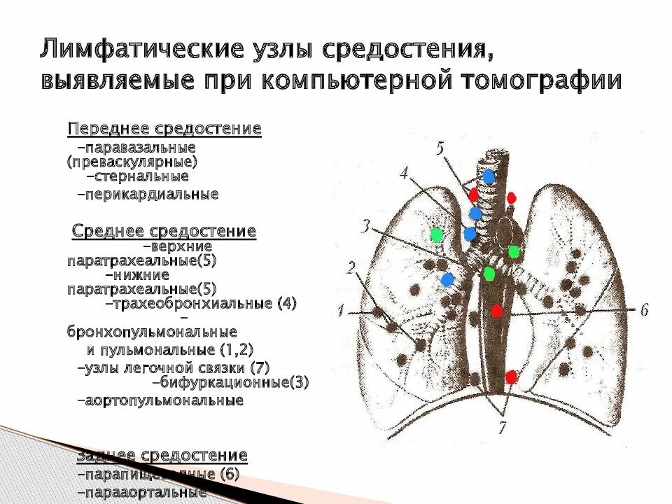 Лимфоузел в легком причина. Кт анатомия лимфатических узлов средостения. Лимфатические узлы средостения на кт. Лимфоузлы средостения схема. Лимфоузлы средостения кт анатомия.