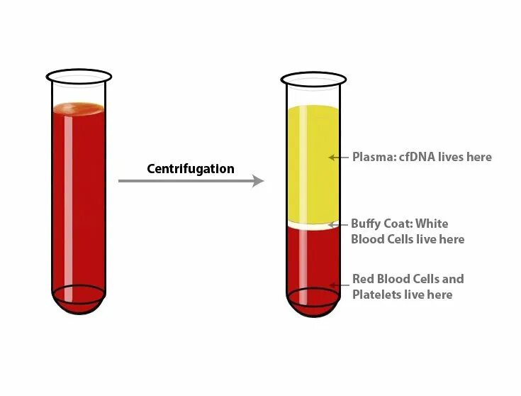 Плазма это кровь. Плазма крови после центрифугирования. Пробирка с кровью после центрифугирования. Кровь после центрифугирования. Расслоение крови в пробирке.