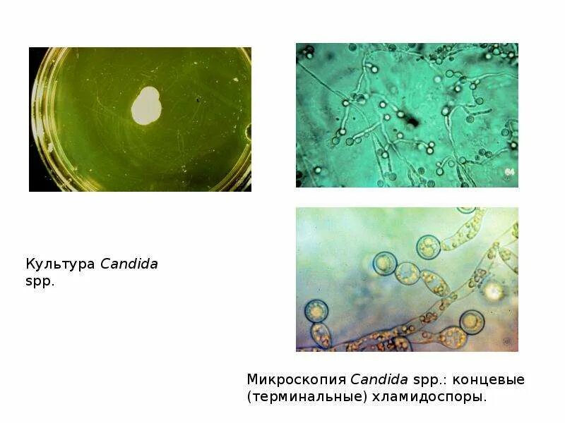 Candida spp ниже порогового значения что это. Грибы кандида микроскопия. грибы кандида под микроскопом. candida auris микроскопия. микология микробиология.
