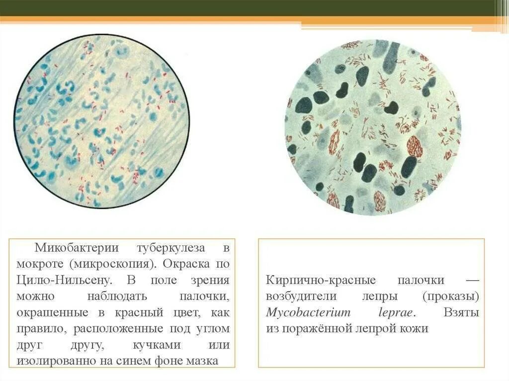 Назначение и типы микропрепаратов из микроорганизмов нативные