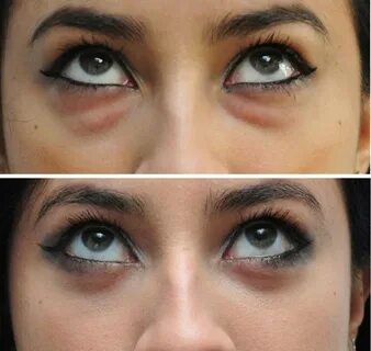 Before eyes
