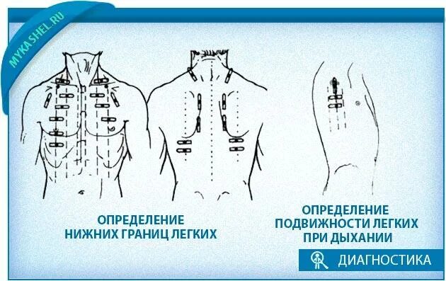 Топографическая перкуссия легких нижние границы легких. Нижние границы лёгких перкуссия. Сравнительная перкуссия легких пропедевтика. Границы легких у здорового человека. Границы легких определяются