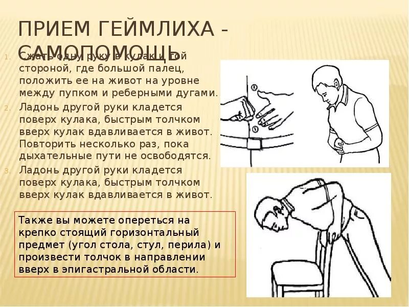 Метод геймлиха это. Прием геймлиха. прием хеймлиха самопомощь. методика геймлиха. приём геймлиха техника.