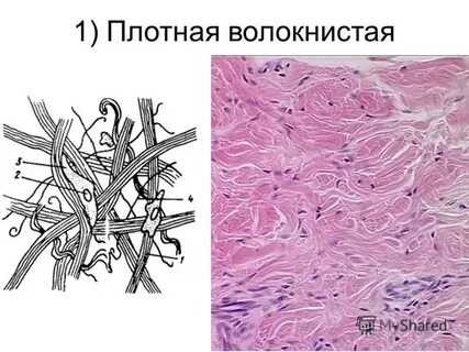 Рисунок волокнистой ткани