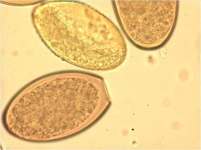 Яйца гельминтов лентеца широкого. Яйца лентеца широкого микроскоп. Микроскопия кала яйца гельминтов. Широкий лентец яйца микроскоп. Купить яйца глист