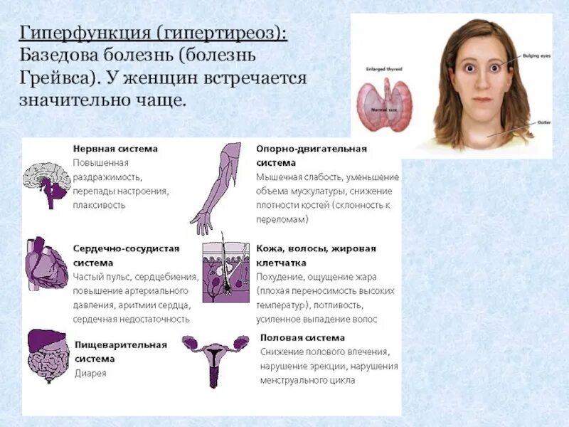 Гипертиреоз симптомы и лечение. Гиперфункция щитовидной железы, базедова болезнь. клинические симптомы гипертиреоза. тиреотоксикоз щитовидной железы. гиперфункция щитовидной железы у детей.