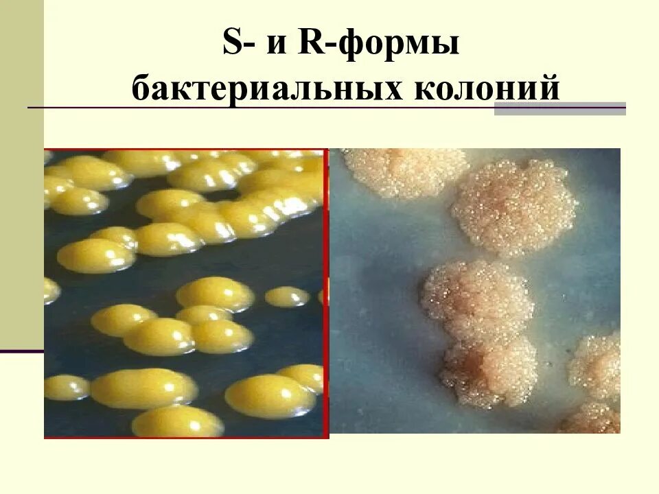 S форма бактерий. Колонии s и r формы. Формы колоний бактерий r s. S И R формы бактерий. S И R колонии микробиология.