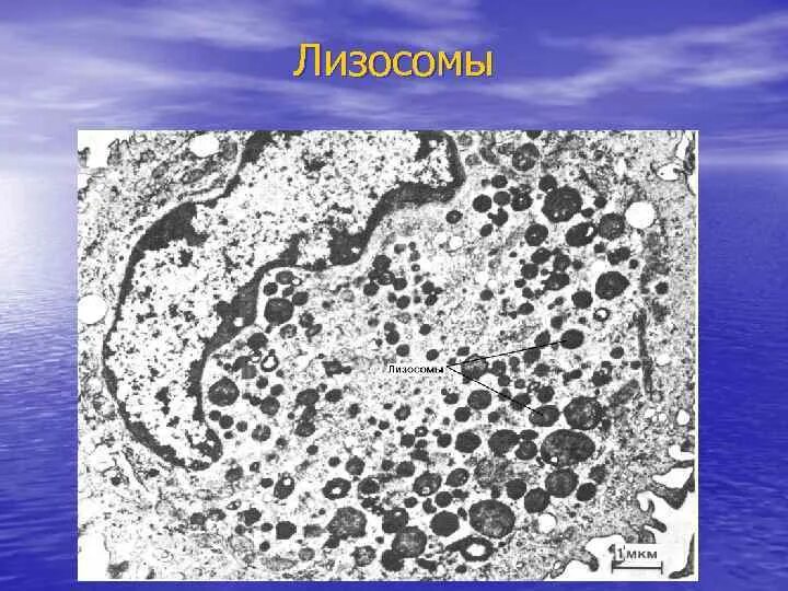 Лизосомы гистология. Электронограмма вторичной лизосомы. Электронограмма вторичной лизосомы. Лизосомы гистология. Лизосомы гистология.