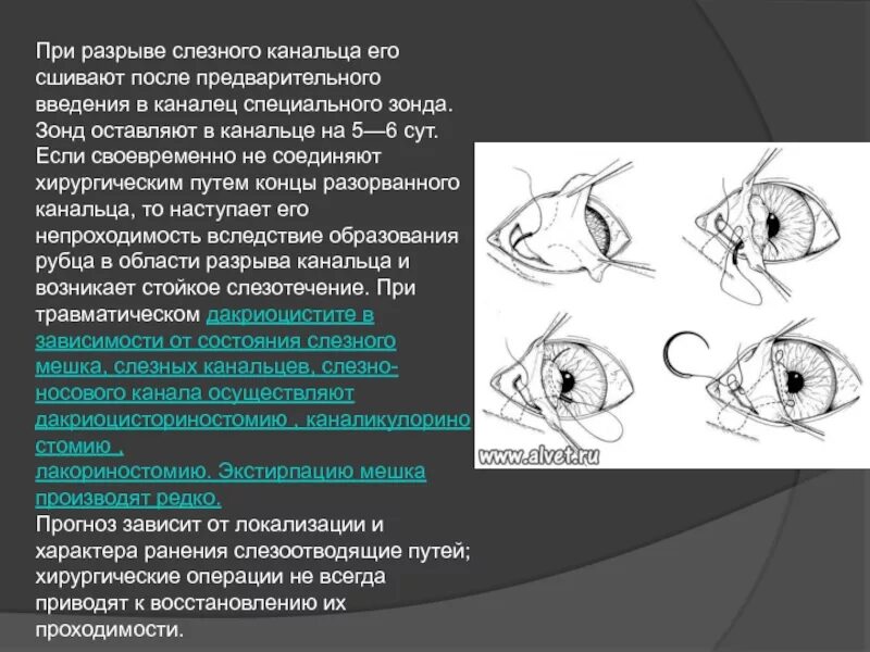 Слезная железа у собак. Операция восстановления проходимости слезных канальцев. Ранение век повреждения слезных органов. Экстирпация железы третьего века. Методы восстановления проходимости слезных канальцев.