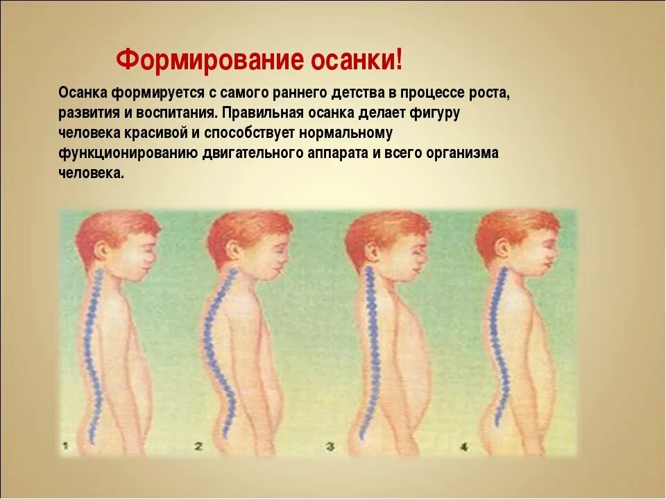 Нарушения осанки возникают. Формирование осанки у детей. формирование правильной оценку у детей. формирование правильной осанки у детей дошкольного возраста. формирование неправильной осанки.