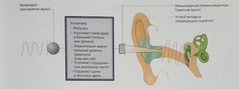 Строение слухового аппарата заушного. Строение слухового аппарата заушного. Действие слухового аппарата. Действие слухового аппарата. Слуховые аппараты презентация.
