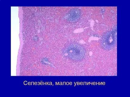 Малая селезенка