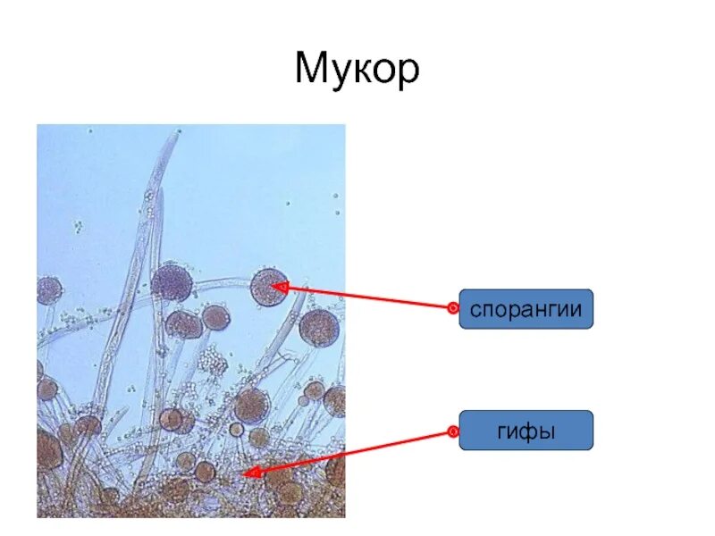 Примеры мукора. Гриб мукор под микроскопом. Строение плесени мукора под микроскопом. Клетка гриба мукора под микроскопом. Строение мицелия мукора.