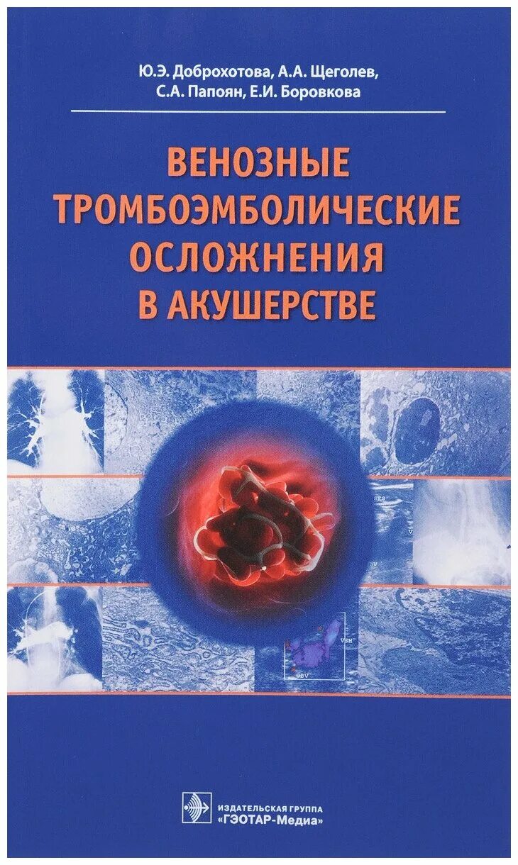 Тромботические осложнения. Венозные тромбоэмболические осложнения. Тромбоэмболические осложнения в акушерстве. Причины тромбоэмболических осложнений в акушерстве и гинекологии.