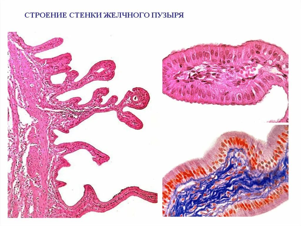 Оболочки желчного пузыря. Гистологическое строение желчного пузыря. Желчный пузырь гистология препарат. Строение желчного пузыря гистология. Строение желчного протока гистология.