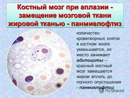 Кроветворную функцию выполняет красный костный