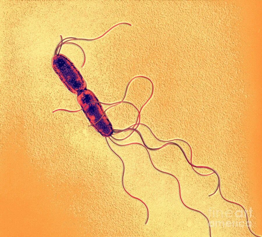 Сальмонелла Typhimurium. Salmonella Typhimurium возбудитель. Сальмонелла enterica. Сальмонелла энтерика. Сальмонеллез б