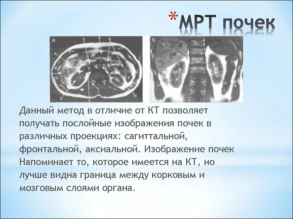 Можно по кт определить. Магнитно-резонансная томография почки опухоль. Компьютерная томография почек с контрастированием. Проекции компьютерной томографии. Кт и мрт почек.