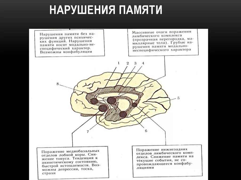 Роль отдельных структур головного мозга в формировании памяти.. Нарушение памяти. Структуры мозга связанные с научением. Локализация памяти в головном мозге. Память в каком отделе мозга