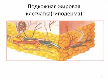 Подкожная хроническая клетчатка