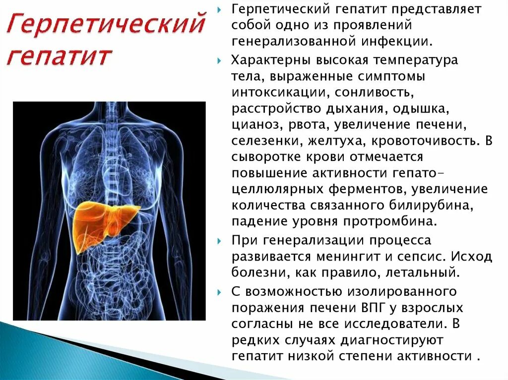 Герпетический гепатит. Поражение печени у ВИЧ инфицированных. Герпесный гепатит у детей. Симптомы герпетического гепатита.