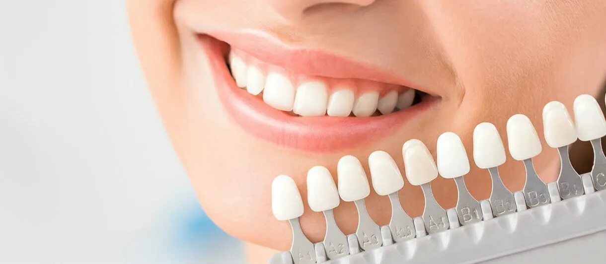 Эстетическая стоматология виниры. Красивые зубы. Отбеливание зубов.