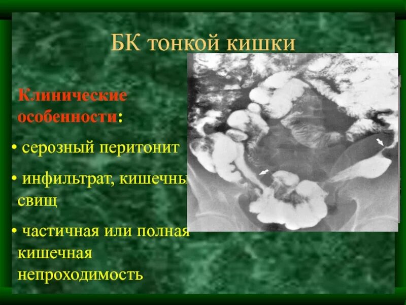 Международный день по искоренению акушерских свищей. Международный день по искоренению акушерских свищей