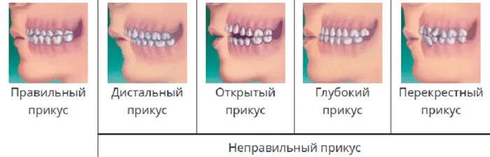 Зубы при закрытом рте