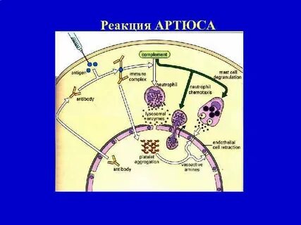 Типа феномена артюса