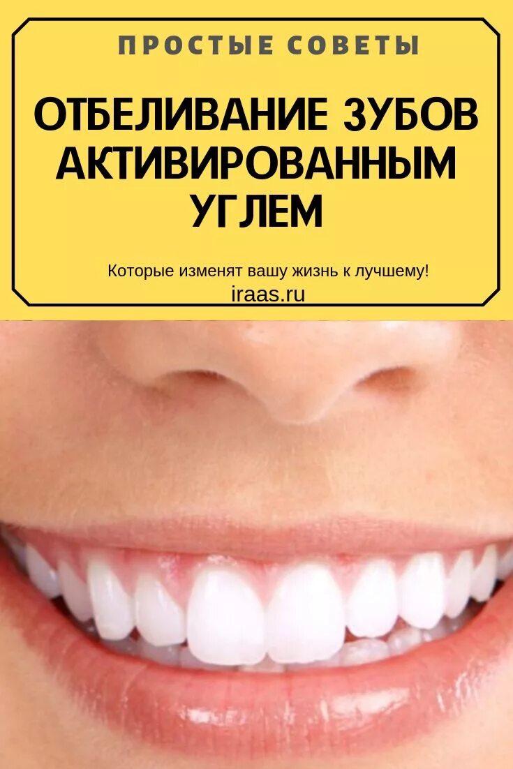 Отбелить зубы активированным углем. Отбелить зубы активированным углем в домашних условиях. Как отбелить зубы активированным углем в домашних условиях.