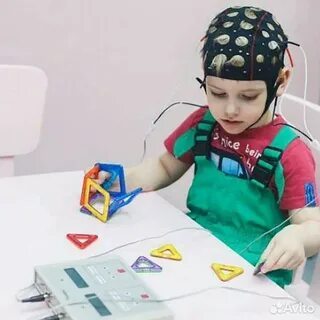 Микрополяризация головного мозга