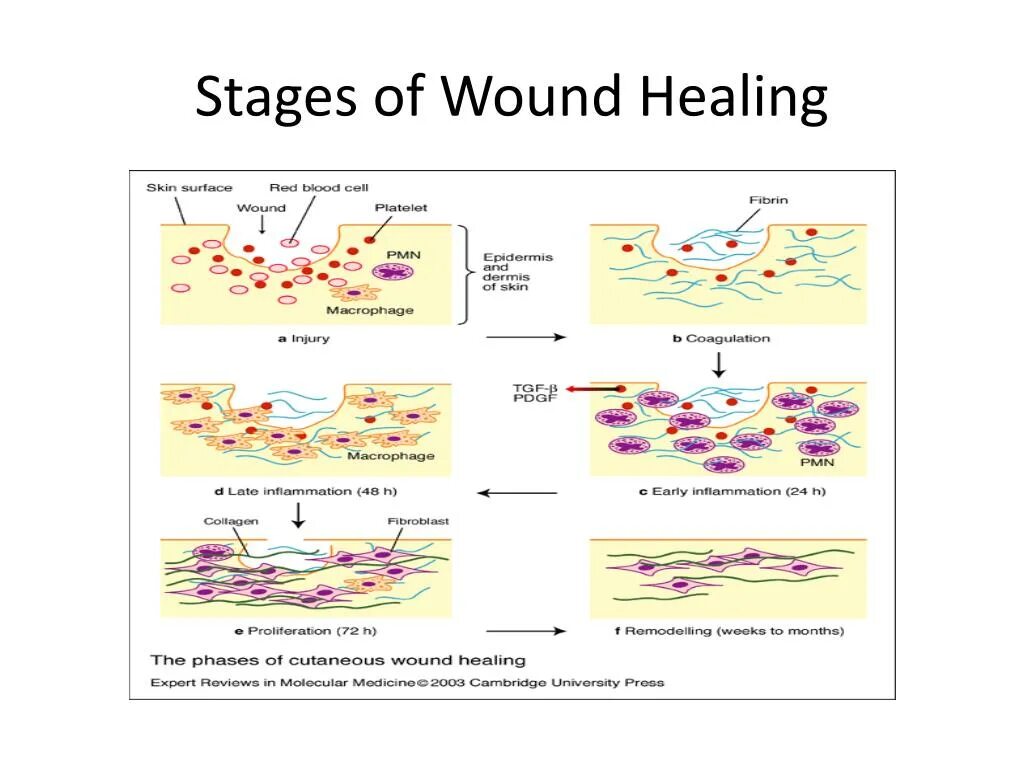 Регенерация воспаление. Wound healing. Fire assay furnaces ecf. Wound healing. Wound healing.