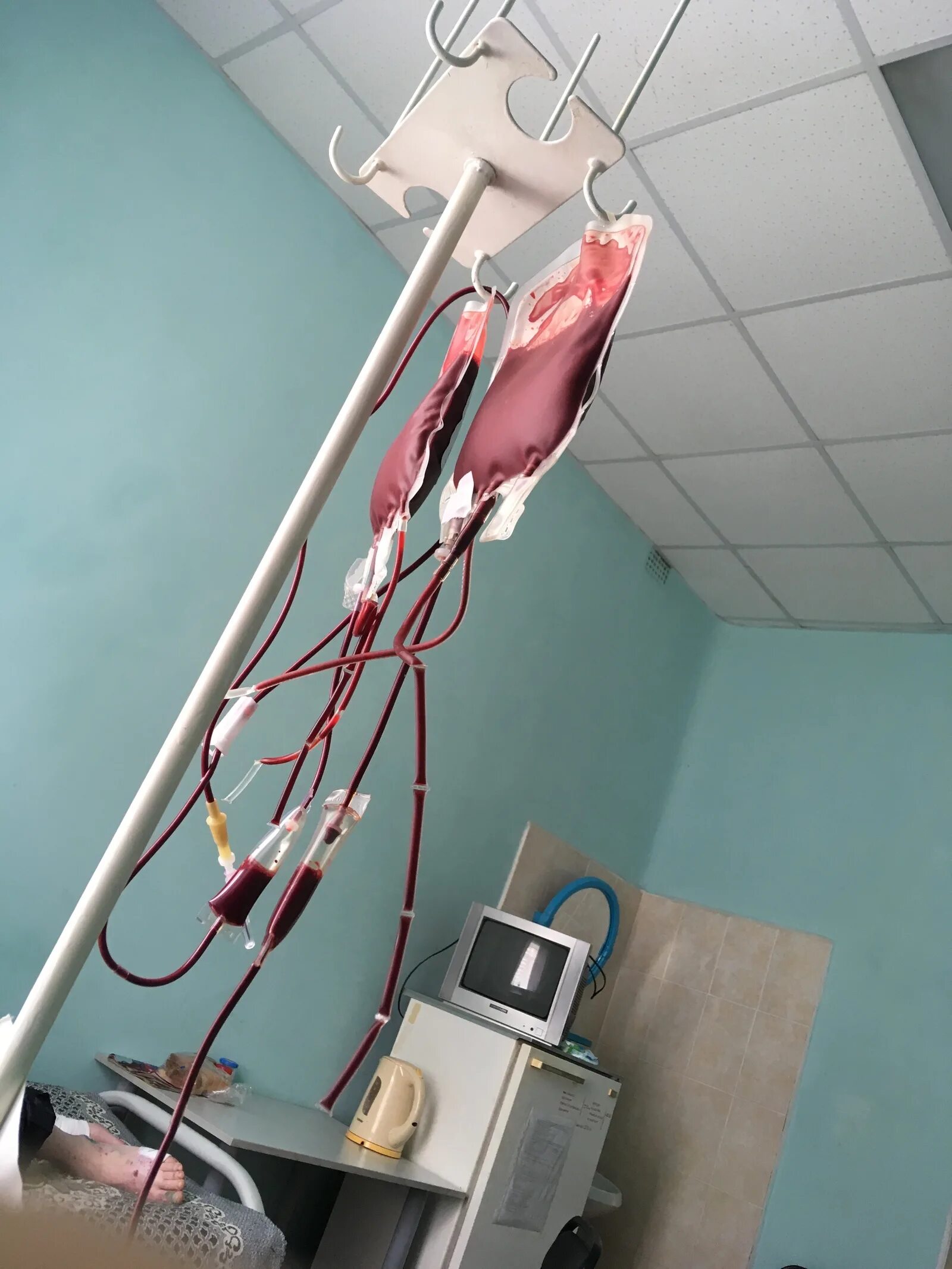Капельница для переливания крови. Переливание крови в больнице. Кровь в больнице