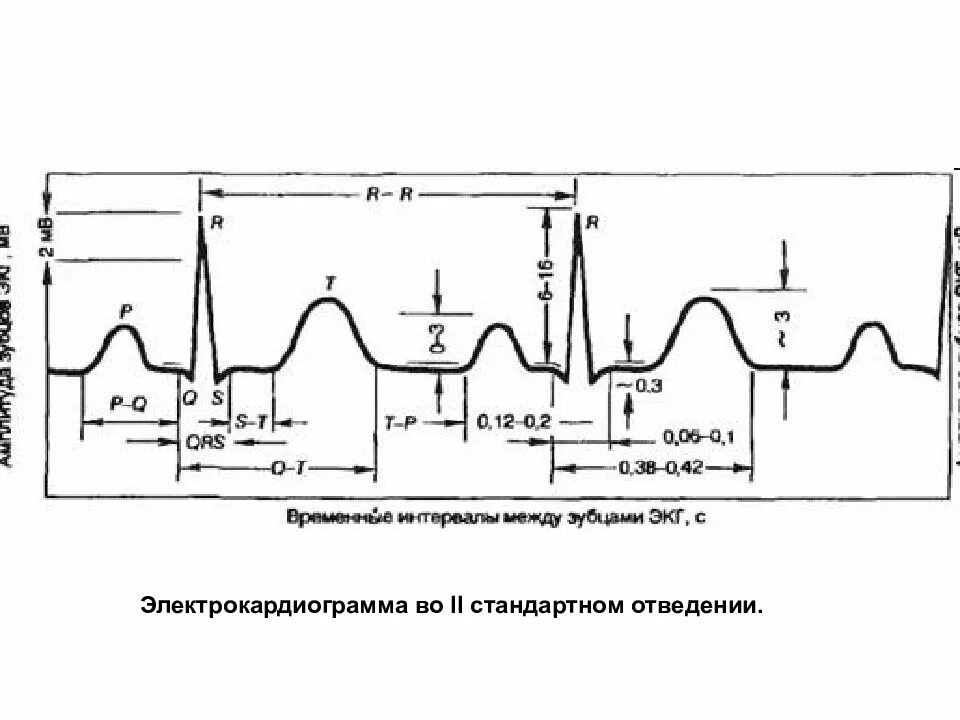 ЭКГ во 2 стандартном отведении физиология. Нормальная электрокардиограмма физиология. ЭКГ здорового человека 2 стандартное отведение. Схема ЭКГ во втором стандартном отведении. Платные услуги экг