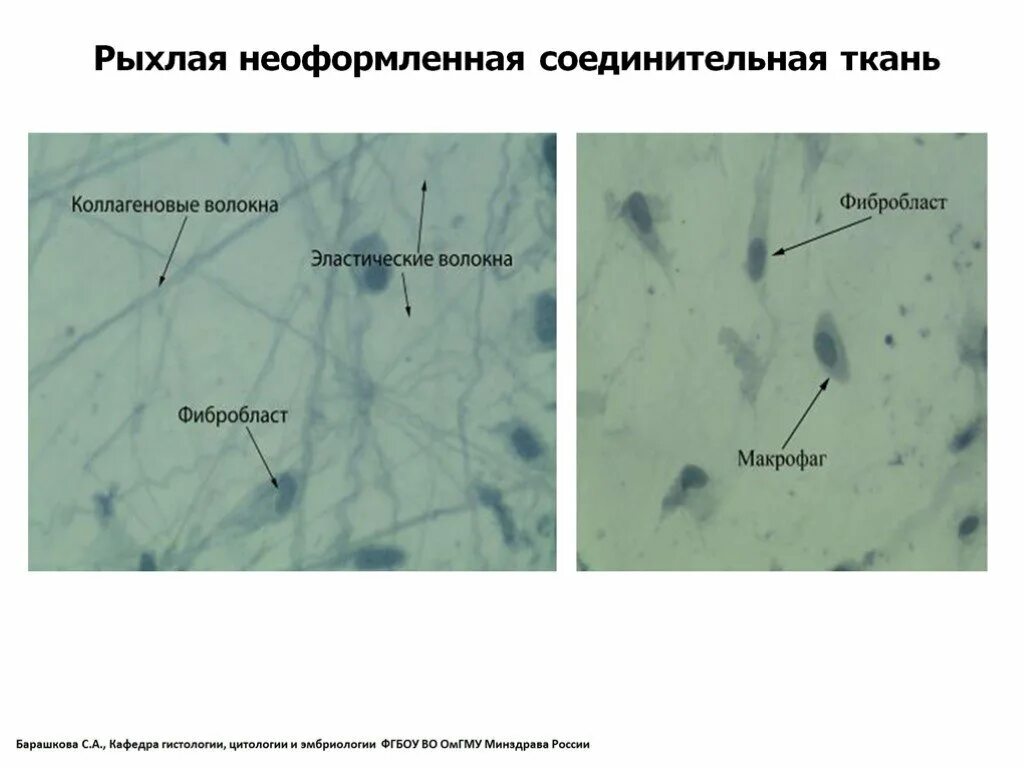Рыхлая плотная неоформленная соединительная ткань. Рыхлая неоформленная соединительная ткань препарат. рыхлая волокнистая неоформленная соединительная ткань препарат. рыхлая неоформленная соединительная ткань препарат гистология. рыхлая соединительная ткань гистология препарат.
